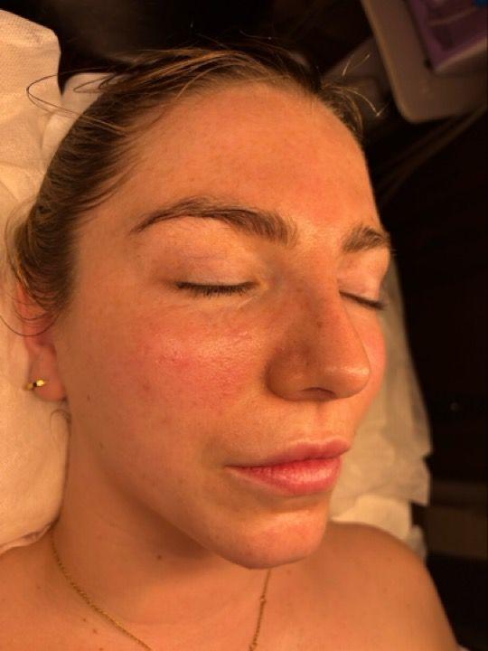 look after Head Massage treatment