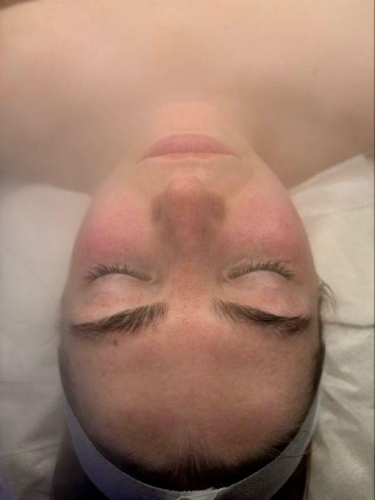 before Head Massage