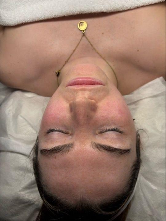 after Head Massage