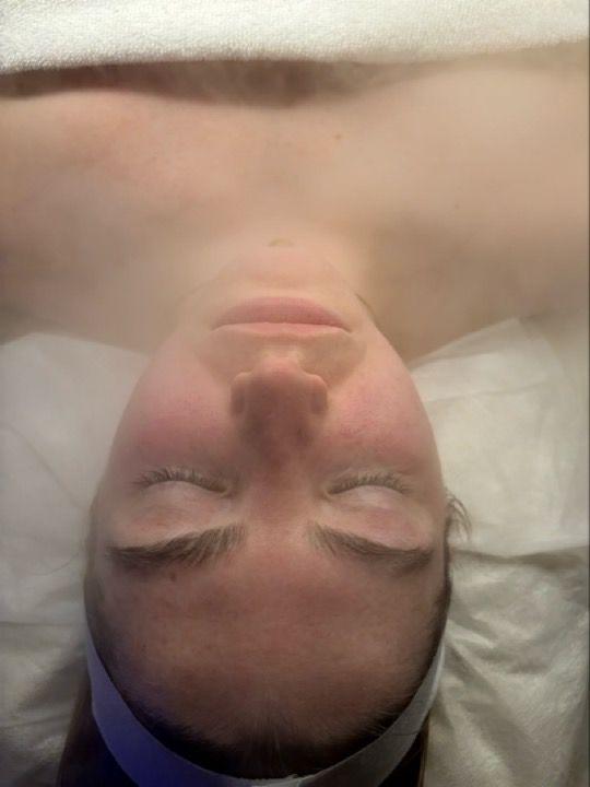 before Head Massage treatment