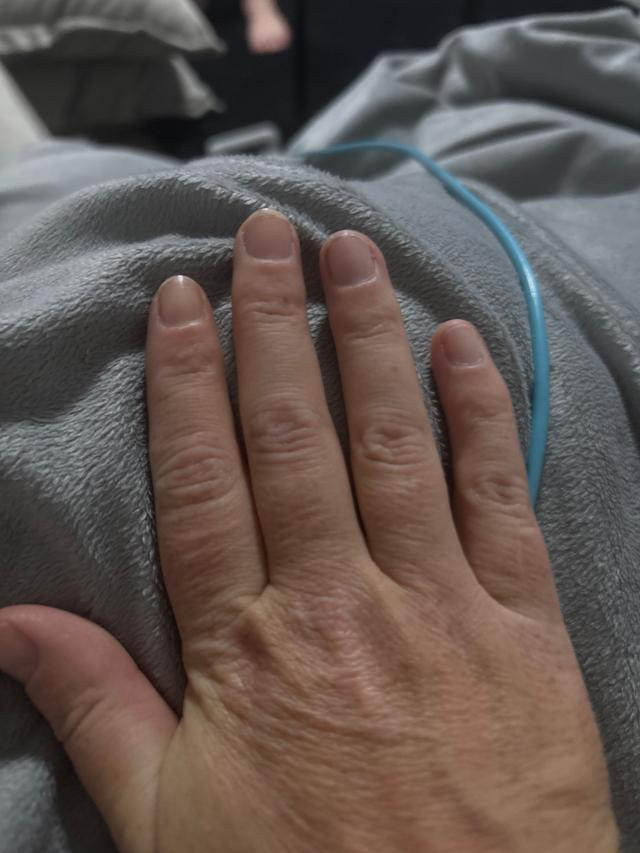 Look before Acrylic Nails treatment