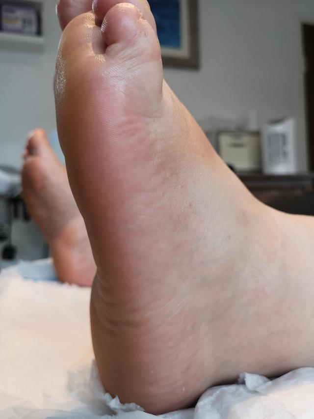 look after Pedicure treatment