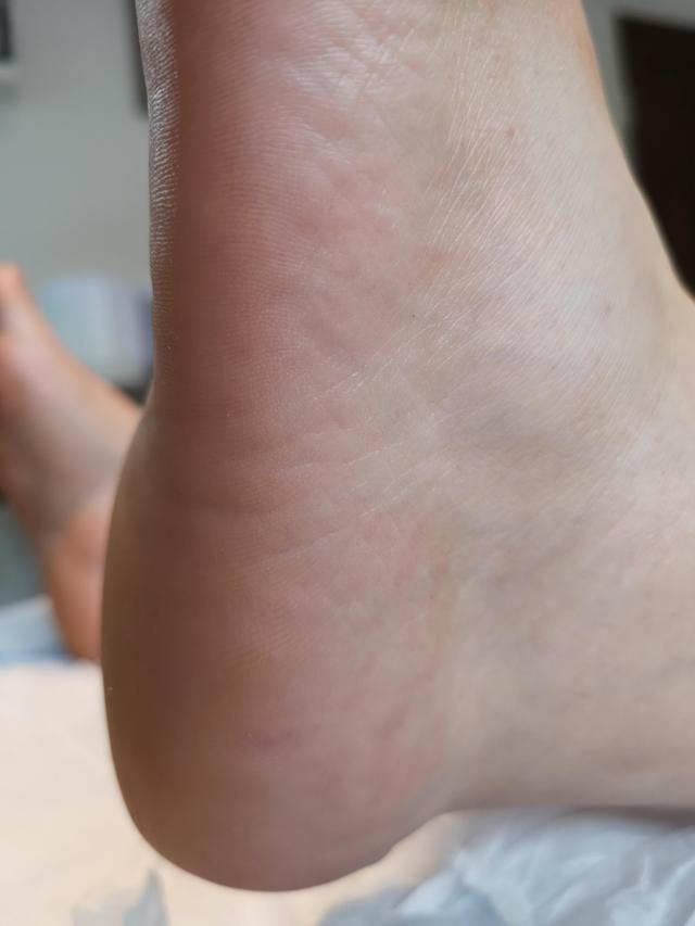 after Pedicure treatment