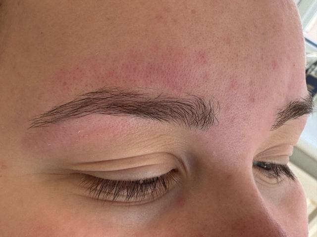 after Lip Waxing