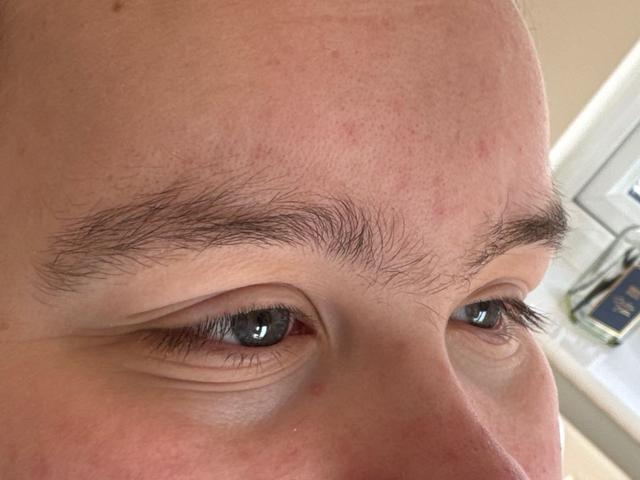before Lip Waxing