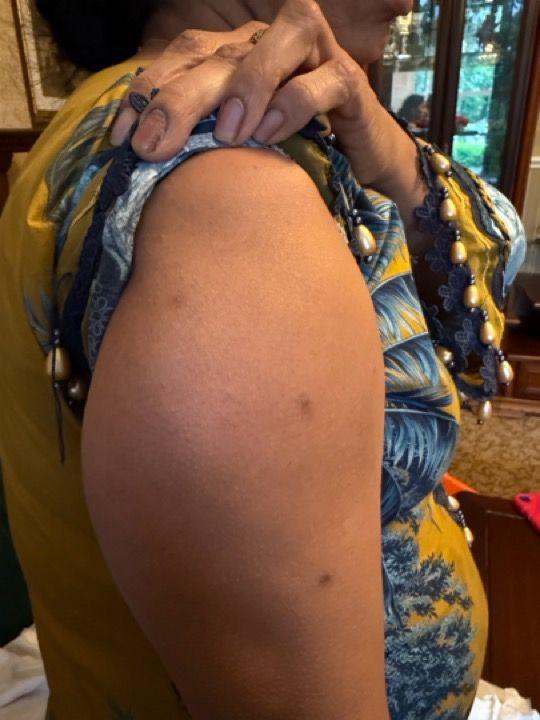 Glutathione Injection Near Me | Book Now