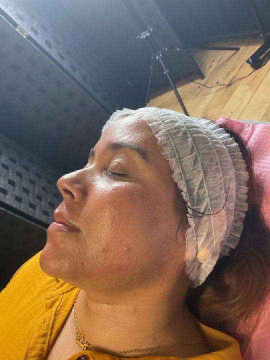look after Skin Lightening treatment
