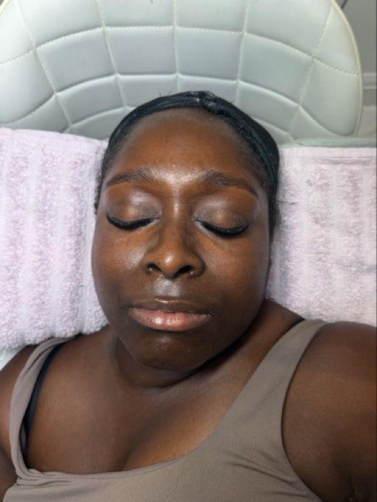 after Brow Waxing