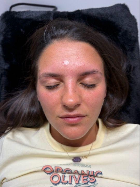 after Brow Shaping treatment