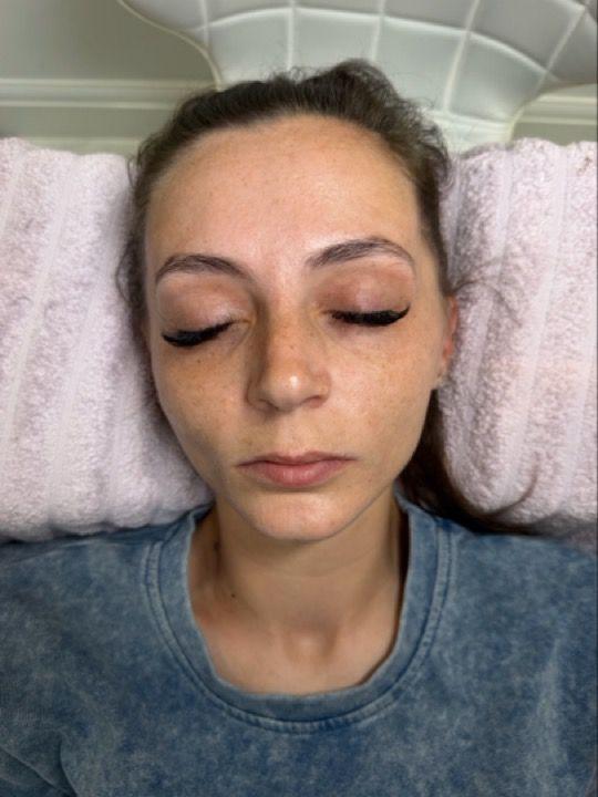 before Brow Shaping