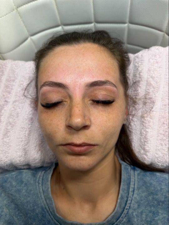 after Brow Shaping