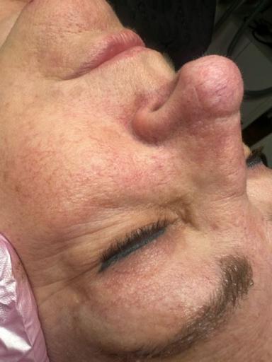 Before