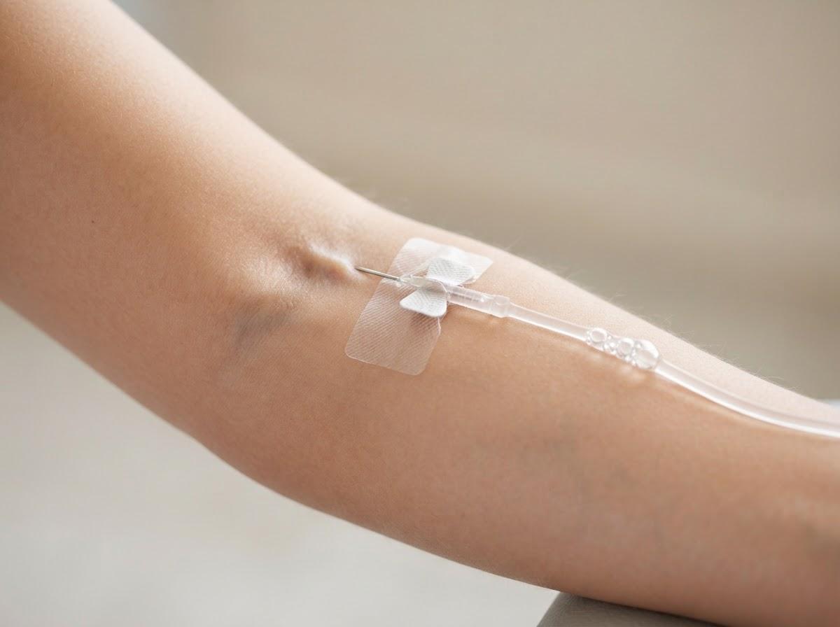 Best Glutathione Injection in Glasgow