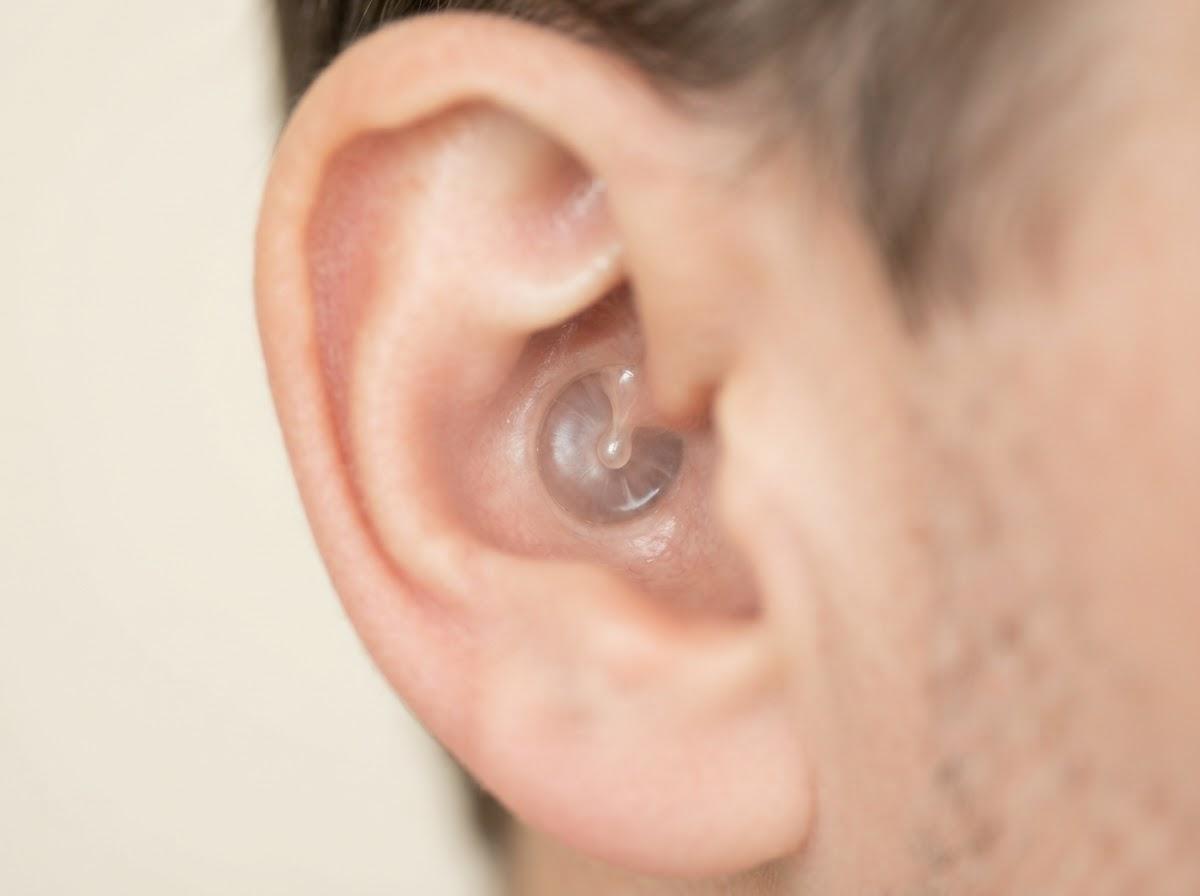 Best Ear Microsuction in London