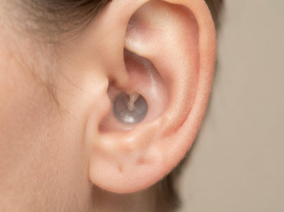 Best Ear Microsuction in Liverpool