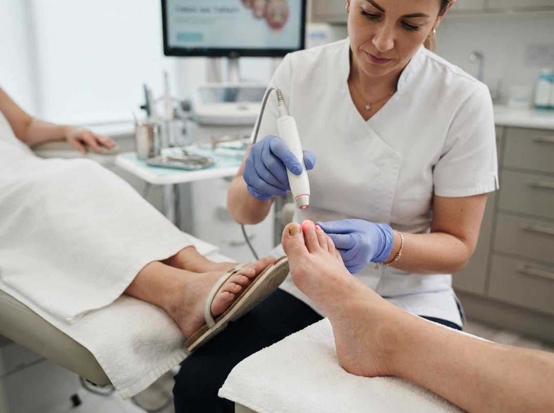Fungal Nail Treatment treatment in Liverpool