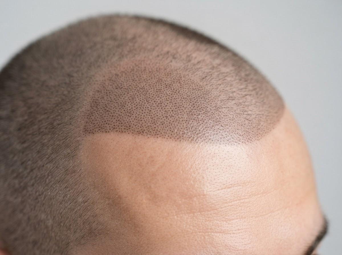 Best Micro Pigmentation in Liverpool
