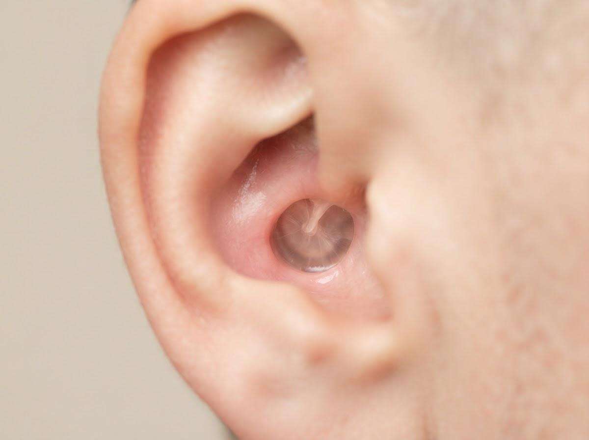 Best Ear Microsuction in Glasgow