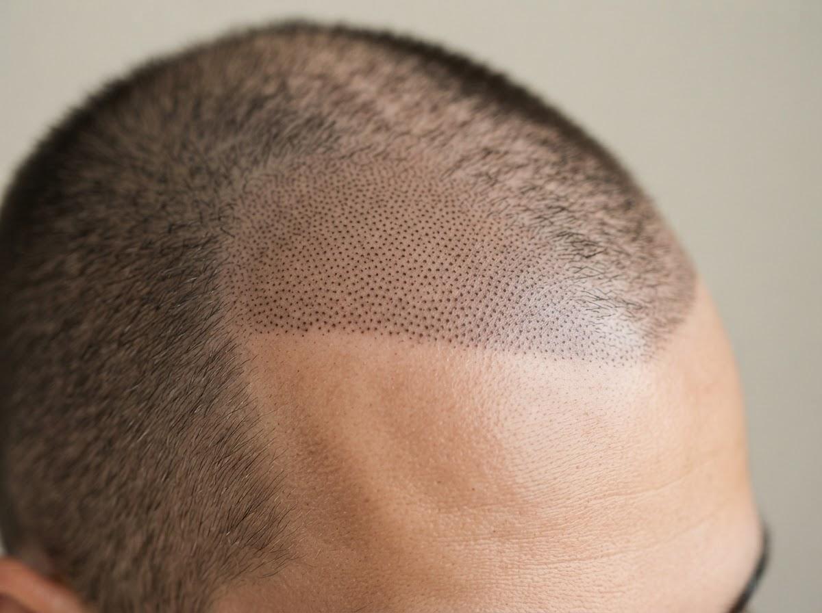 Best Micro Pigmentation in Glasgow