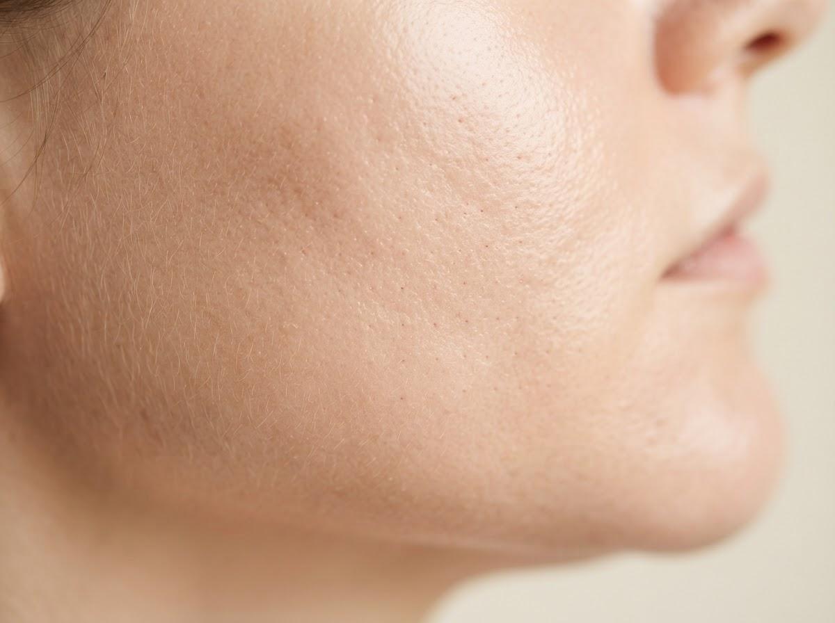 Best Mesotherapy in London