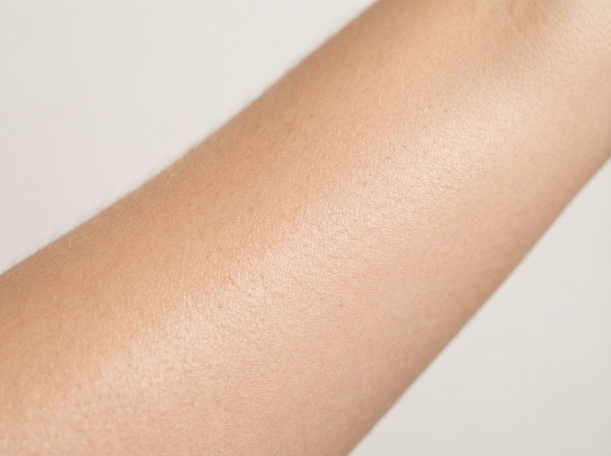 Best Microneedling in London