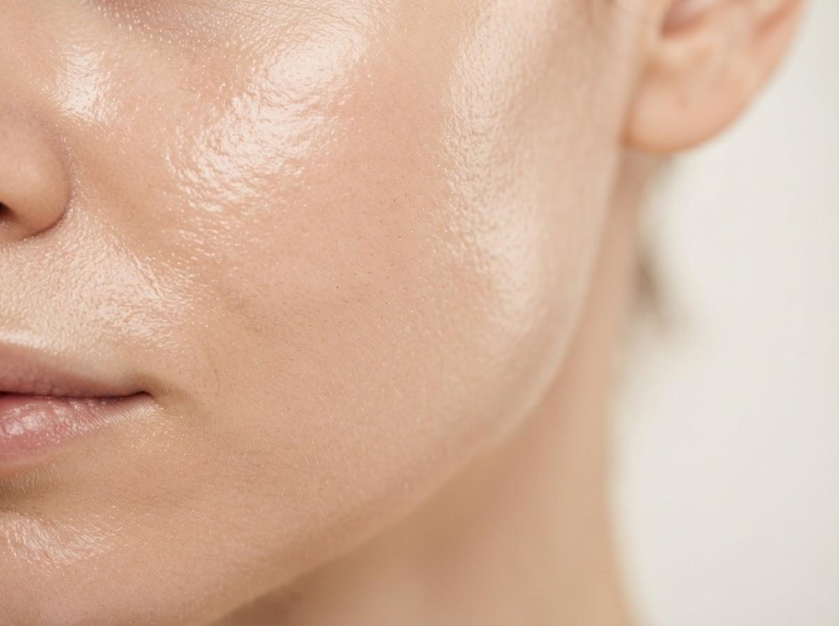 Best Mesotherapy in Birmingham