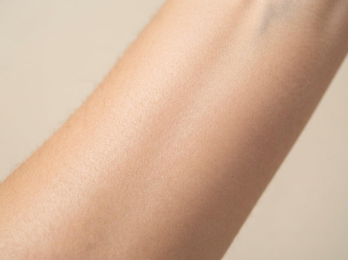 Best Microneedling in Manchester