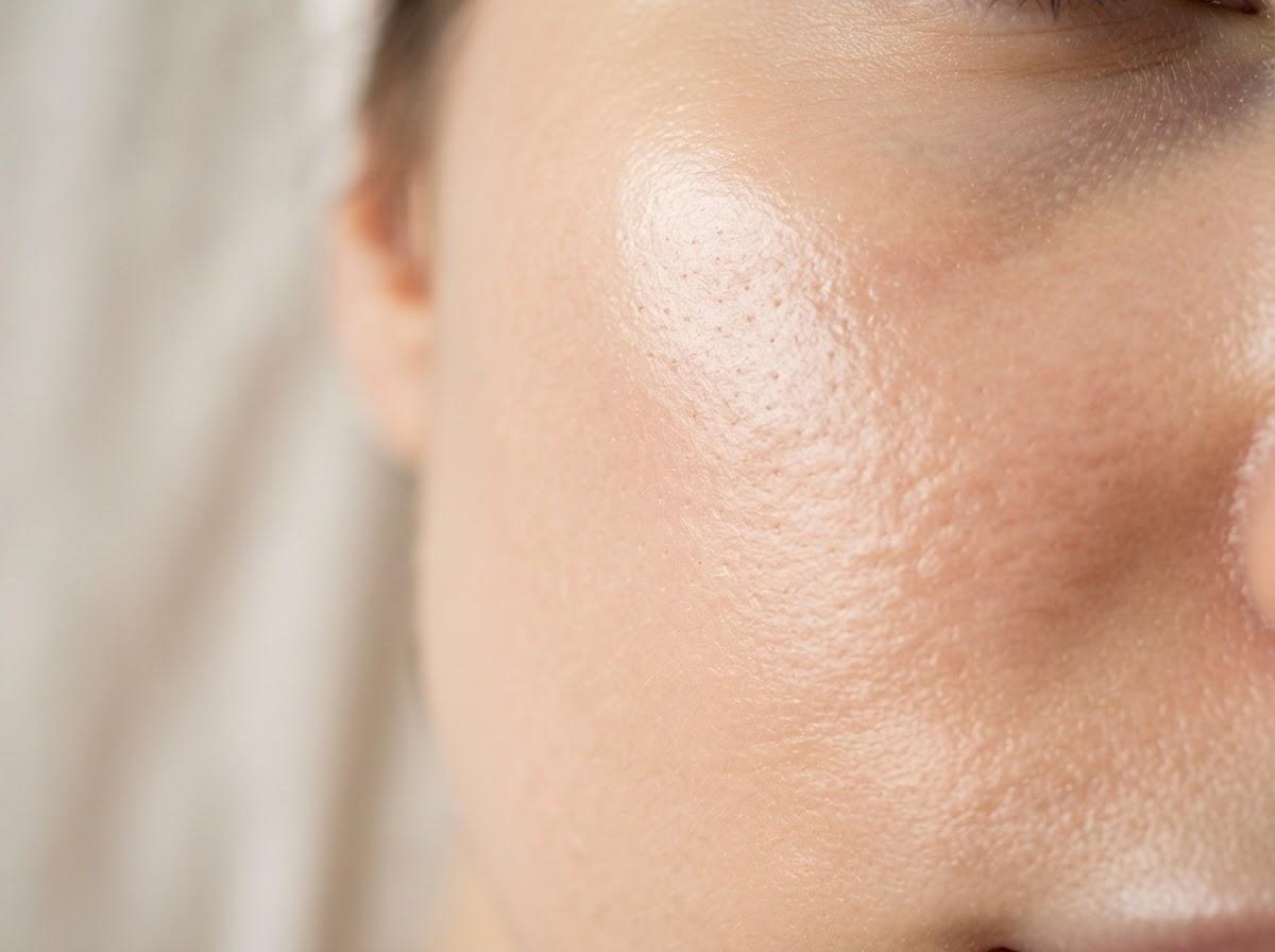 Best Mesotherapy in Liverpool