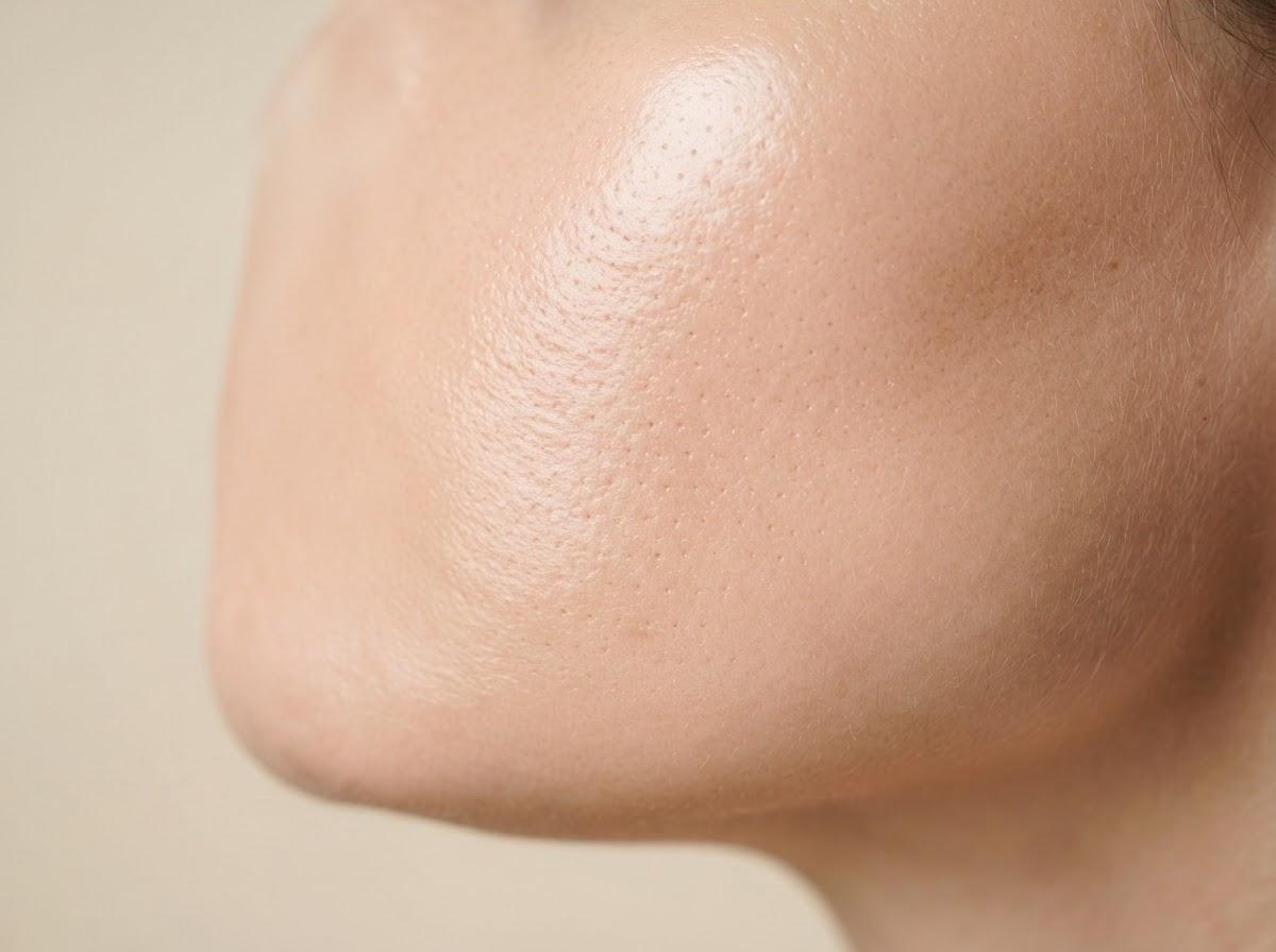 Best Mesotherapy in Glasgow