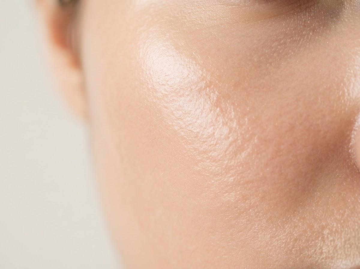 Best Skin Booster in London
