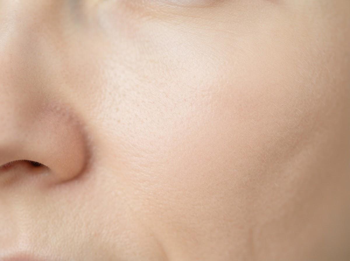 Best Thread Vein Removal in Birmingham