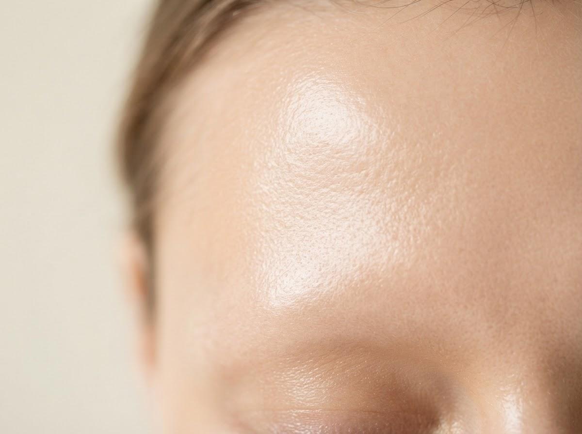 Best Microdermabrasion in Manchester