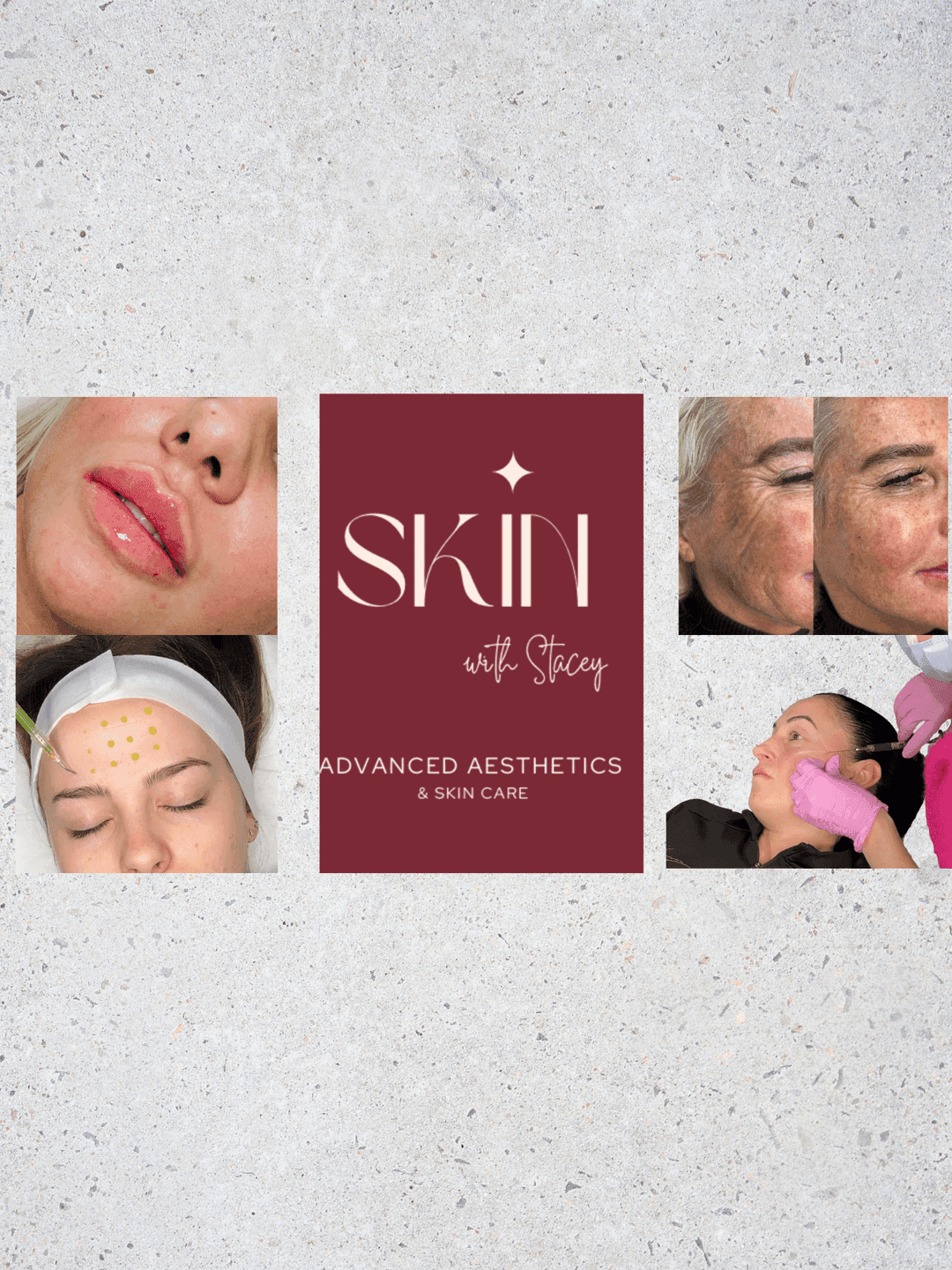 Skin with Stacey image 1